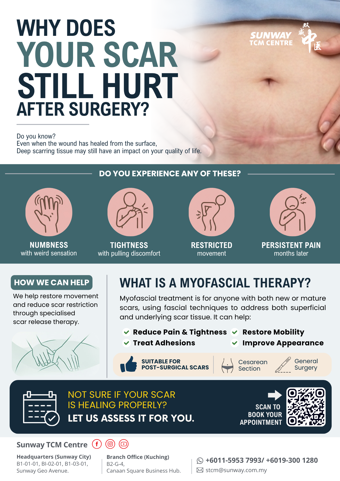 Post-Surgery Scar Pain & Tightness? Specialized Scar Myofascial Therapy ...