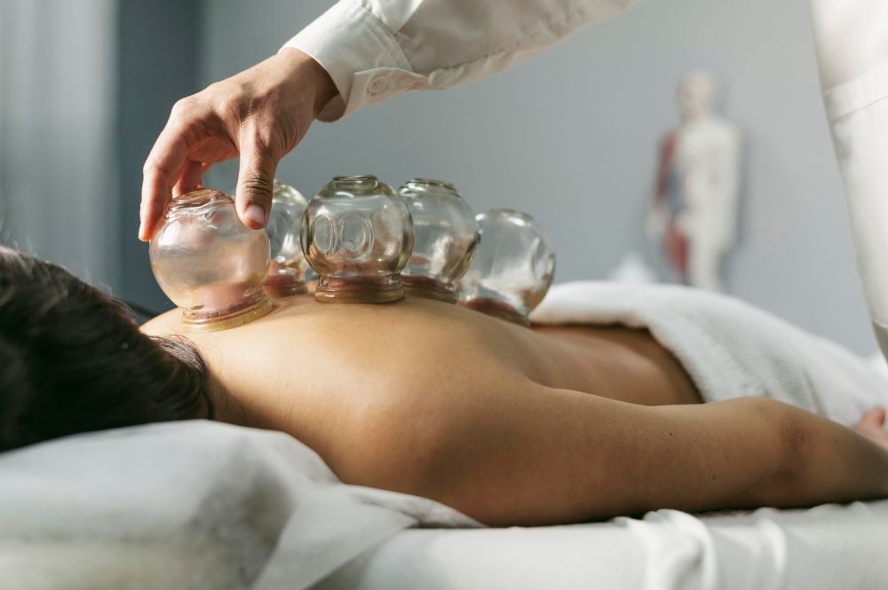 Cupping, an ancient healing practice for stimulating blood circulation