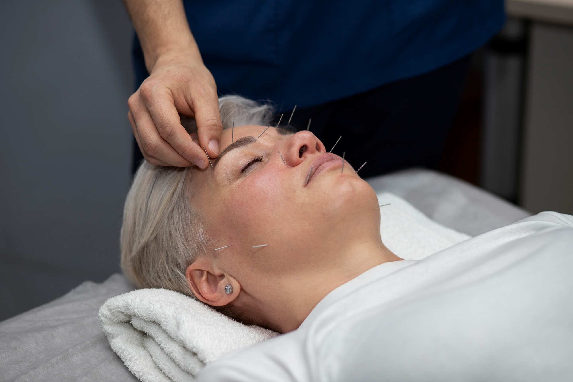 Difference between ear and full body acupuncture