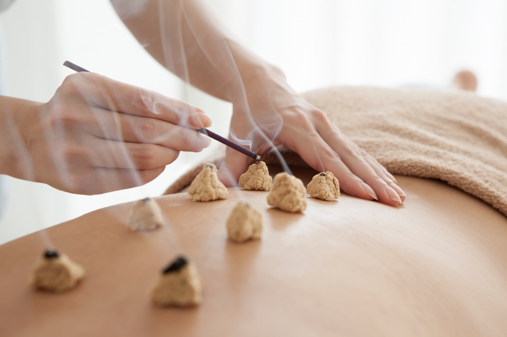 Providing warmth through moxibustion treatment